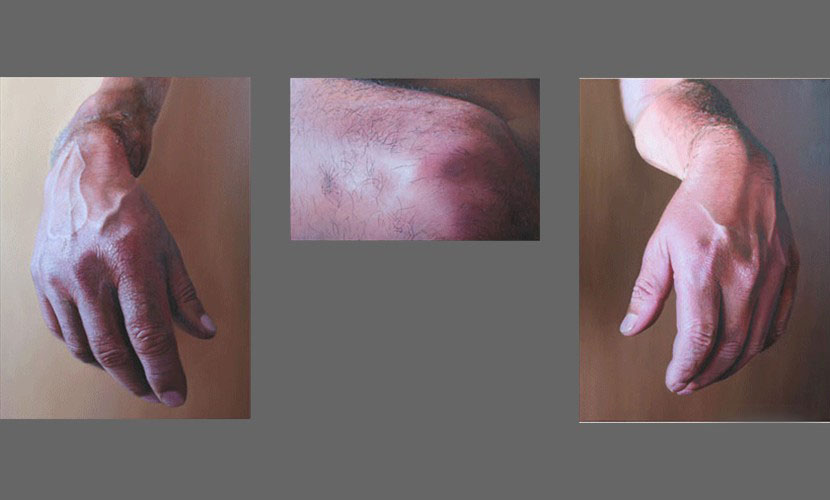 Mano rodilla - 2007